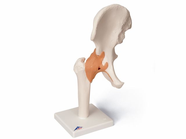 Articulação Coxofemoral Luxo - A81/1 - 3B Scientific Articulação Coxofemoral Luxo - A81/1 - 3B Scientific