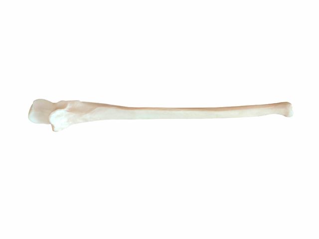 Ulna - A45/2 - 3B Scientific