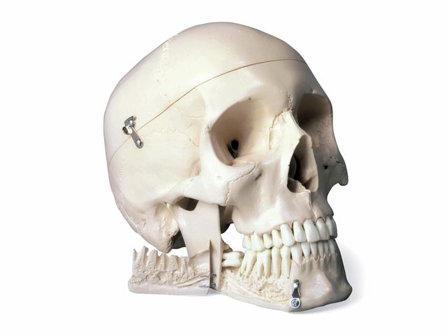 Crânio com Dentes Extratíveis 4 Peças - W10532 - 3B Scientific Crânio com Dentes Extratíveis 4 Peças - W10532 - 3B Scientific