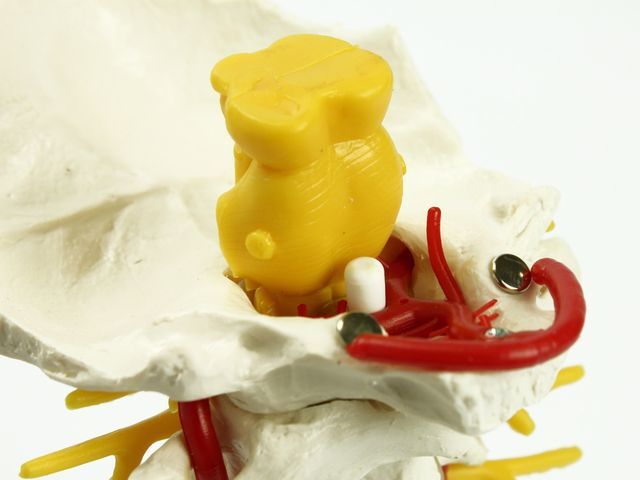 Coluna Vertebral Cervical - A72 - 3B Scientific Coluna Vertebral Cervical - A72 - 3B Scientific