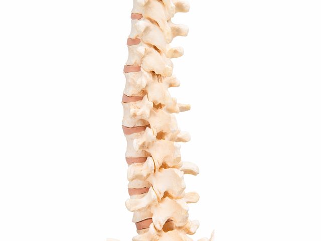 Coluna Vertebral - A794 - BONElike™ - 3B Scientific Coluna Vertebral - A794 - BONElike™ - 3B Scientific