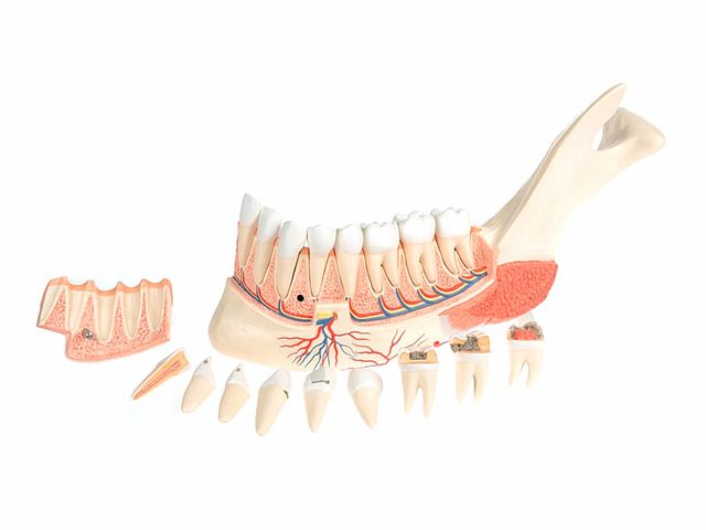 Metade Inferior da Mandíbula Avançada - em 19 Partes - VE290 - 3B Scientific Metade Inferior da Mandíbula Avançada - em 19 Partes - VE290 - 3B Scientific
