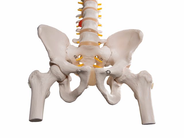 Coluna Clássica Flexível com Cabeças de Fêmur e Disco Intervertebral Prolapso - A58/2 - 3B Scientific Coluna Clássica Flexível com Cabeças de Fêmur e Disco Intervertebral Prolapso - A58/2 - 3B Scientific
