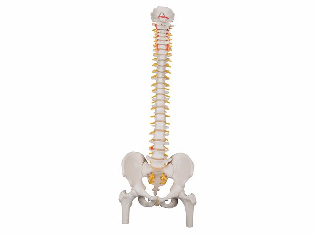 Coluna Clássica Flexível com Cabeças de Fêmur e Disco Intervertebral Prolapso - A58/2 - 3B Scientific Coluna Clássica Flexível com Cabeças de Fêmur e Disco Intervertebral Prolapso - A58/2 - 3B Scientific