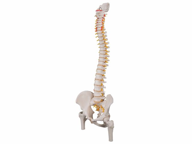 Coluna Clássica Flexível com Cabeças de Fêmur e Disco Intervertebral Prolapso - A58/2 - 3B Scientific Coluna Clássica Flexível com Cabeças de Fêmur e Disco Intervertebral Prolapso - A58/2 - 3B Scientific