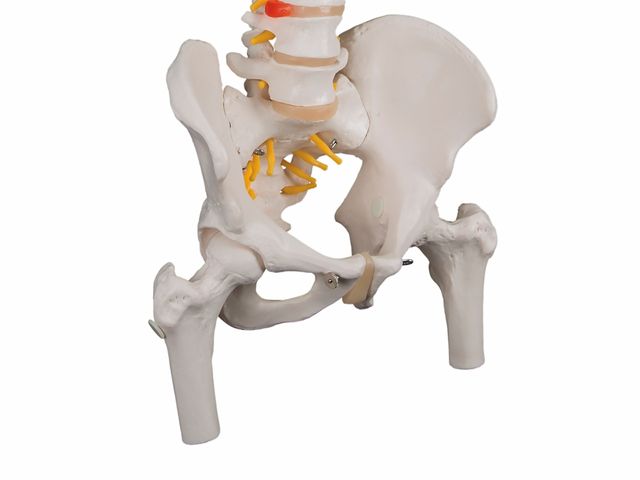Coluna Clássica Flexível com Cabeças de Fêmur e Disco Intervertebral Prolapso - A58/2 - 3B Scientific Coluna Clássica Flexível com Cabeças de Fêmur e Disco Intervertebral Prolapso - A58/2 - 3B Scientific