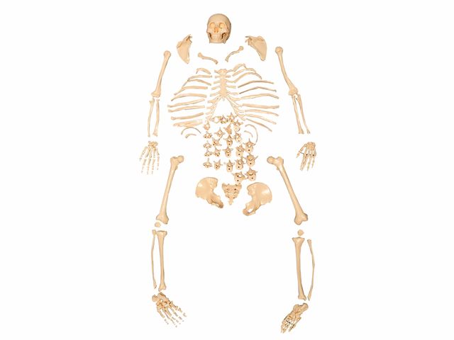 Esqueleto em Tamanho Natural Desarticulado - TGD 0101-C - Anatomic Esqueleto em Tamanho Natural Desarticulado - TGD 0101-C - Anatomic