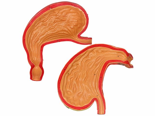 Estômago em 2 Partes - TGD-0326 - Anatomic Estômago em 2 Partes - TGD-0326 - Anatomic