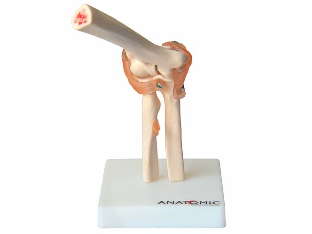 Articulação do Cotovelo - TGD-0161-C - Anatomic Articulação do Cotovelo - TGD-0161-C - Anatomic