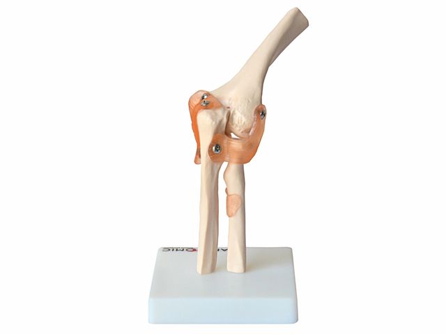 Articulação do Cotovelo - TGD-0161-C - Anatomic Articulação do Cotovelo - TGD-0161-C - Anatomic