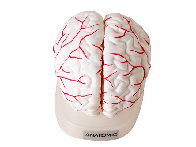 Cérebro com Artérias Desmontável em 8 Partes - TGD-0303 -Anatomic Cérebro com Artérias Desmontável em 8 Partes - TGD-0303 -Anatomic
