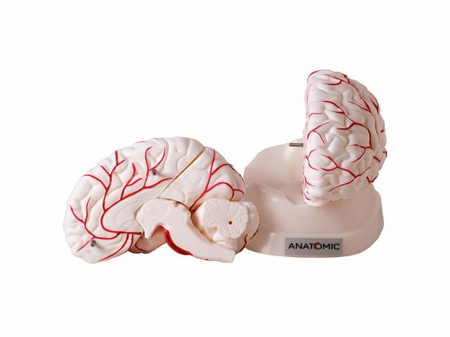 Cérebro com Artérias Desmontável em 8 Partes - TGD-0303 -Anatomic Cérebro com Artérias Desmontável em 8 Partes - TGD-0303 -Anatomic