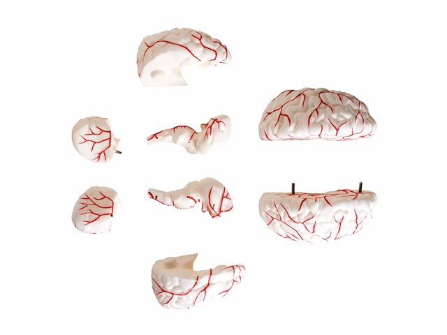 Cérebro com Artérias Desmontável em 8 Partes - TGD-0303 -Anatomic Cérebro com Artérias Desmontável em 8 Partes - TGD-0303 -Anatomic