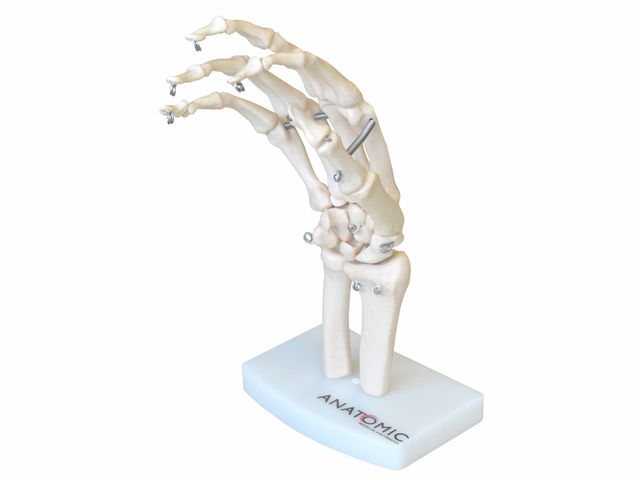Esqueleto da Mão com Ossos do Punho - TGD-0157-B - Anatomic Esqueleto da Mão com Ossos do Punho - TGD-0157-B - Anatomic