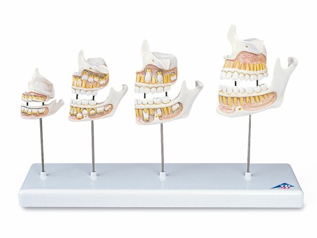 Desenvolvimento da Dentição - em 4 Estágios - D20 - 3B Scientific