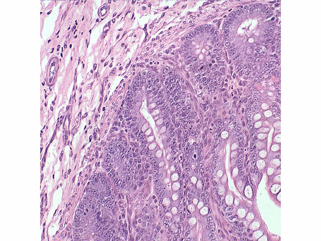Conjunto de Lâminas Preparadas de Histologia - TIL-H-80 - 80 Peças - Anatomic Conjunto de Lâminas Preparadas de Histologia - TIL-H-80 - 80 Peças - Anatomic