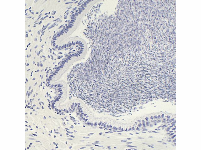 Conjunto de Lâminas Preparadas de Histologia - TIL-H-80 - 80 Peças - Anatomic Conjunto de Lâminas Preparadas de Histologia - TIL-H-80 - 80 Peças - Anatomic