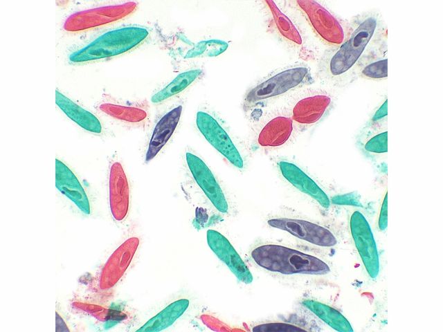 Conjunto de Lâminas Preparadas de Parasitologia - TIL-P-30 - 30 Peças - Anatomic Conjunto de Lâminas Preparadas de Parasitologia - TIL-P-30 - 30 Peças - Anatomic
