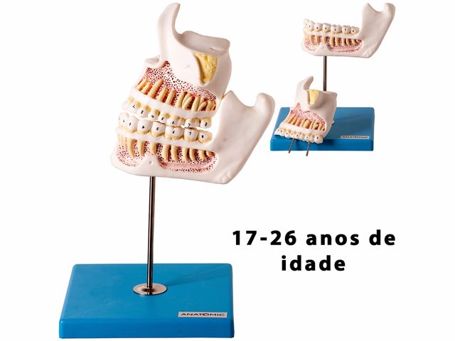 Modelo de Desenvolvimento da Dentição - TZJ 0313 D - Anatomic Modelo de Desenvolvimento da Dentição - TZJ 0313 D - Anatomic