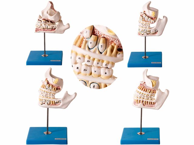 Modelo de Desenvolvimento da Dentição - TZJ 0313 D - Anatomic Modelo de Desenvolvimento da Dentição - TZJ 0313 D - Anatomic