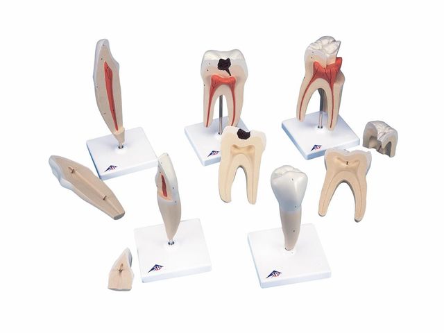 Série Clássica de Modelos de Dentes - 8x o Tamanho Natural - D10 - 3B Scientific Série Clássica de Modelos de Dentes - 8x o Tamanho Natural - D10 - 3B Scientific
