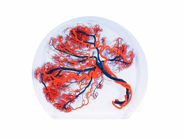 Modelo de Placenta - W10604 - 3B Scientific Modelo de Placenta - W10604 - 3B Scientific