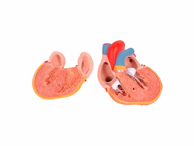 Coração Clássico com Hipertrofia Ventricular - em 2 Partes - G04 - 3B Scientific Coração Clássico com Hipertrofia Ventricular - em 2 Partes - G04 - 3B Scientific