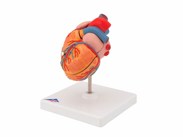 Coração Clássico com Hipertrofia Ventricular - em 2 Partes - G04 - 3B Scientific Coração Clássico com Hipertrofia Ventricular - em 2 Partes - G04 - 3B Scientific