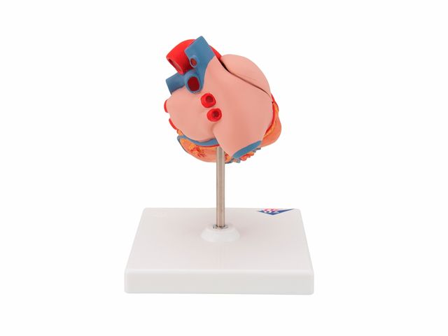 Coração Clássico com Hipertrofia Ventricular - em 2 Partes - G04 - 3B Scientific Coração Clássico com Hipertrofia Ventricular - em 2 Partes - G04 - 3B Scientific