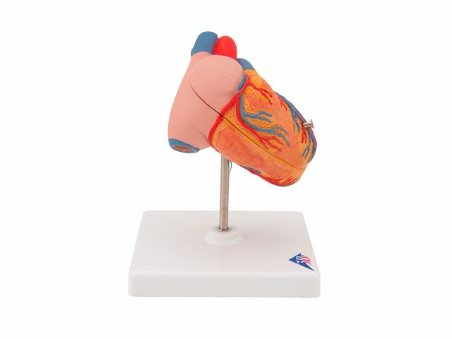 Coração Clássico com Hipertrofia Ventricular - em 2 Partes - G04 - 3B Scientific Coração Clássico com Hipertrofia Ventricular - em 2 Partes - G04 - 3B Scientific