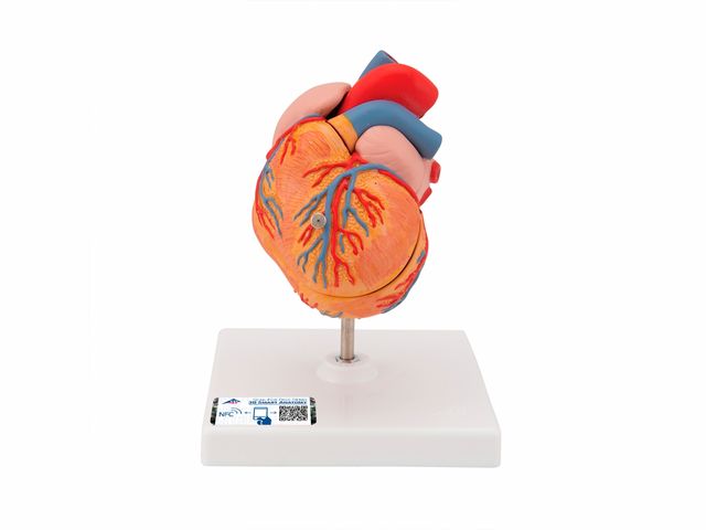 Coração Clássico com Hipertrofia Ventricular - em 2 Partes - G04 - 3B Scientific Coração Clássico com Hipertrofia Ventricular - em 2 Partes - G04 - 3B Scientific