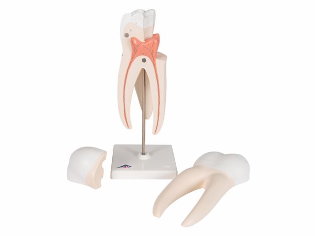 Molar Superior com Raiz Tripla - em 3 Partes - 3B Scientific Molar Superior com Raiz Tripla - em 3 Partes - 3B Scientific