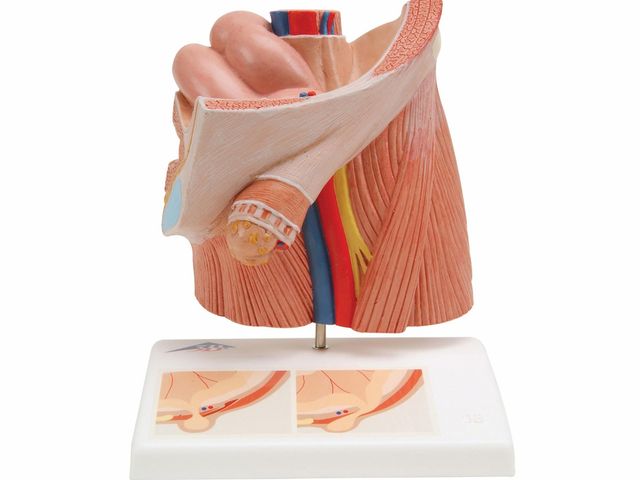 Modelo de Hérnia Inguinal - H13 - 3B Scientific Modelo de Hérnia Inguinal - H13 - 3B Scientific