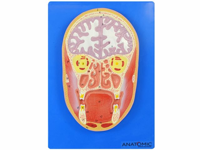Cabeça em Corte Frontal - TZJ-0305 - Em Placa - Anatomic