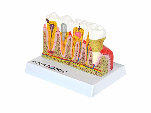 Patologias Dentárias - em Placa Explicativa - TGD-0311-J - Anatomic Patologias Dentárias - em Placa Explicativa - TGD-0311-J - Anatomic