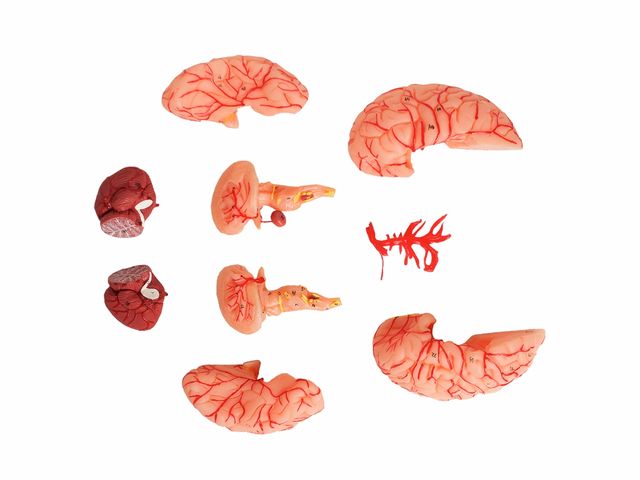 Cérebro com Artérias em 9 Partes - TZJ-0303-A - Anatomic Cérebro com Artérias em 9 Partes - TZJ-0303-A - Anatomic