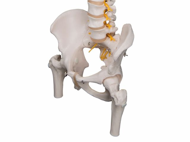 Coluna Flexível Luxo com Cabeças de Fêmur e Disco Intervertebral Prolapso - A58/6 - 3B Scientific Coluna Flexível Luxo com Cabeças de Fêmur e Disco Intervertebral Prolapso - A58/6 - 3B Scientific