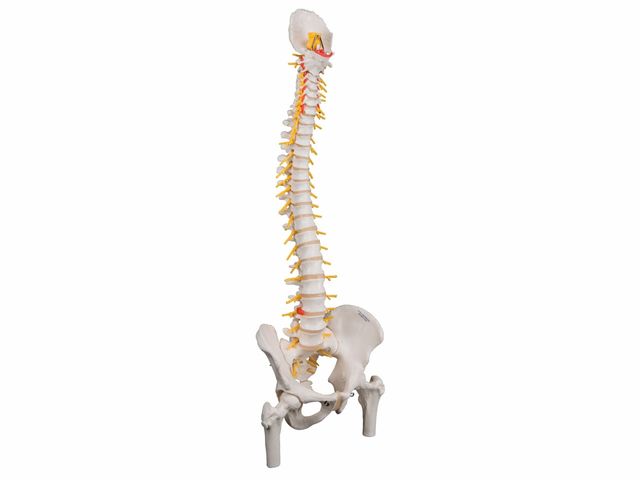 Coluna Flexível Luxo com Cabeças de Fêmur e Disco Intervertebral Prolapso - A58/6 - 3B Scientific Coluna Flexível Luxo com Cabeças de Fêmur e Disco Intervertebral Prolapso - A58/6 - 3B Scientific