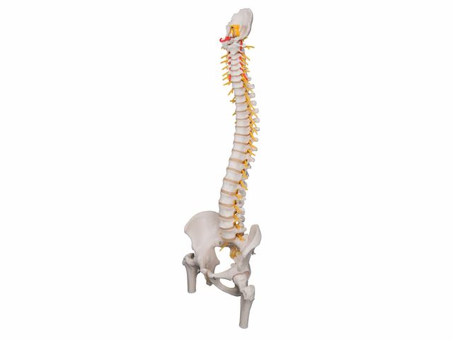 Coluna Flexível Luxo com Cabeças de Fêmur e Disco Intervertebral Prolapso - A58/6 - 3B Scientific Coluna Flexível Luxo com Cabeças de Fêmur e Disco Intervertebral Prolapso - A58/6 - 3B Scientific