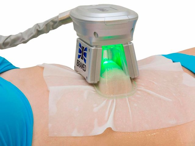Polarys Ibramed - Aparelho de Criolipólise com 3 aplicadores Polarys Ibramed - Aparelho de Criolipólise com 3 aplicadores