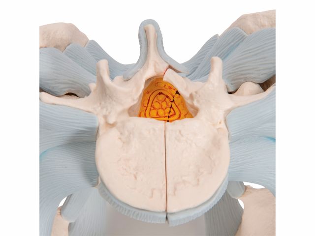Esqueleto Pélvico Masculino com Ligamentos em 2 Partes - H21/2 - 3B Scientific Esqueleto Pélvico Masculino com Ligamentos em 2 Partes - H21/2 - 3B Scientific